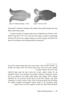 The Practical Bris Milah Primer